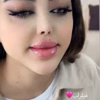 فیلر(ژل)و بوتاکس|خدمات آرایشگری و زیبایی|سهند, |دیوار