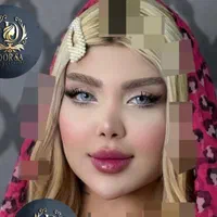تزریق تخصصی ژل ومادلینگ خلیجی واروپایی وبوتاکس