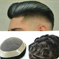 پروتز مو|آرایشی، بهداشتی، درمانی|اهواز, اهواز|دیوار