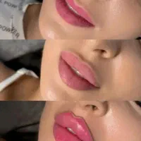 آموزش وتزریق،ژل،بوتاکس،مزوژل زیرچشم،آنزیم ومزو|خدمات آرایشگری و زیبایی|کرج, فاز ۳ گوهردشت|دیوار
