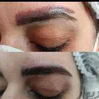 کلینیک تخصصی پاک کردن تتو با لیزر تضمینی/ریمو ابرو|خدمات آرایشگری و زیبایی|مشهد, کوثر|دیوار
