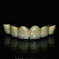 لابراتوار(لابور.لابراتور)دندانسازی  دندان مصنوعی|خدمات آرایشگری و زیبایی|مشهد, آزادشهر|دیوار