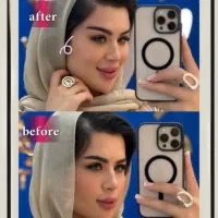 مرکز تخصصی تزریق فول فیس چربی و فیلر/لیفت با نخ|خدمات آرایشگری و زیبایی|مشهد, هنرستان|دیوار