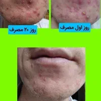 درمان کبد چرب با پاکسازی بدن