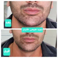 کلینیک زیبایی رز(رویال سابق)|خدمات آرایشگری و زیبایی|دورود, |دیوار