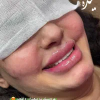 خدمات ژل عربی ‌خلیجی زیبادرکلینیک|خدمات آرایشگری و زیبایی|پرند, فاز ۵|دیوار