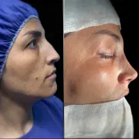عمل بینی|خدمات آرایشگری و زیبایی|دوگنبدان, |دیوار