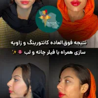 نیاز فوری به مانکن جهت تزریق بوتاکس و فیلر لب|خدمات آرایشگری و زیبایی|تهران, امانیه|دیوار