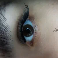 کاشت مژه هیدن تخفیف ویژه