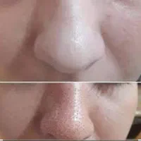 فیشیال، پلاسماو الکترولیز، لاغری فقط خانم ها|خدمات آرایشگری و زیبایی|اصفهان, عسگریه|دیوار