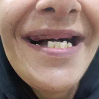 دندان سازی