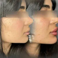 آفر ویژه زیبایی
