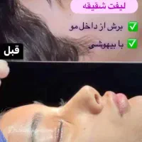 جشنواره بلفارو پلاستی پلک فقط 8500|خدمات آرایشگری و زیبایی|اصفهان, بهار آزادی|دیوار