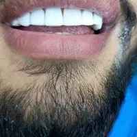 دندانپزشکی در خرم آباد با تخفیف ویژه