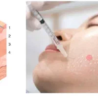 پی آر پی گرینراتریش جواب انی،جشنواره دوعدد باژل800|خدمات آرایشگری و زیبایی|تهران, دروازه شمیران|دیوار