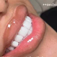 مرکز خدمات کامپوزیت دندان شیراز دندانپزشکی|خدمات آرایشگری و زیبایی|شیراز, قصرالدشت|دیوار