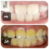 درمان بیماری هاباطب سنتی واصلاح مزاج|خدمات آرایشگری و زیبایی|بروجن, |دیوار