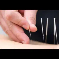 آموزش تخصصی طب سوزنی مناسب برای تمامی افراد
