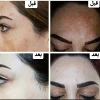 کرم وی ای پی اصل صدرصد تضمینی سفیدکننده قوی|حراج|یاسوج, |دیوار