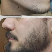کوسه هم با من ریشاش در اومد