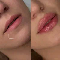 زیبایی با اصالت، توسط پزشک