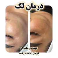 آموزش و خدمات پاکسازی پوست چالوس|خدمات آرایشگری و زیبایی|چالوس, |دیوار