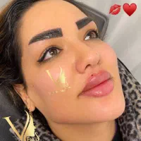 تزریق بوتاکس و فیلر تخصصی،کراتینه مووفیشیال تخصصی