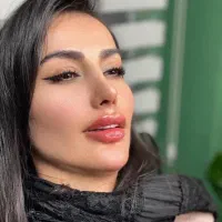 جشنواره تخفیفات تزریق ژل و بوتاکس و...|خدمات آرایشگری و زیبایی|کرج, گوهردشت|دیوار