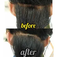 درمان قطعی رشک و شپش باکمترین هزینه|خدمات آرایشگری و زیبایی|اسلامشهر, شهرک قائمیه|دیوار