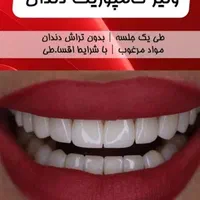 جشنواره تابستانی کامپوزیت دندان