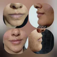 ژل و بوتاکس با ماندگاری بالا و قیمت ویژه|خدمات آرایشگری و زیبایی|شاهین‌شهر, شهرک گلدیس|دیوار