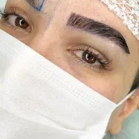 کاشت تخصصی ابرو