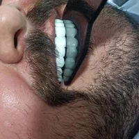 دندان سازی|خدمات آرایشگری و زیبایی|خوی, |دیوار