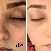 سفید کننده قوی