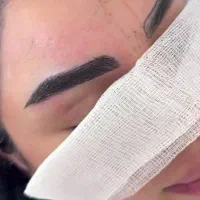 کاشت ابرو میکروکاشت