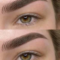 میکروبیلدینگ شیدینگ فیبروز خط چشم