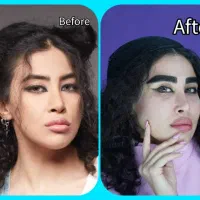 کاشت ابرو/کاشت مو/بلفاروپلاستی