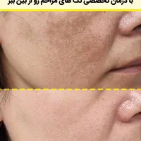 زیبایی|خدمات آرایشگری و زیبایی|شیراز, دینکان|دیوار