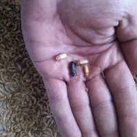 شفیره کرم میلورم