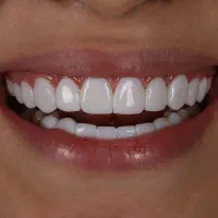 خدمات زیبایی دندان گلد دنت