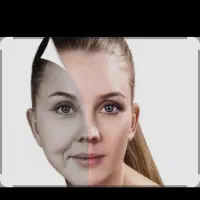 پی آر پی مزواگزوزومPRF.پی آرپی،پی اراف فقط 950
