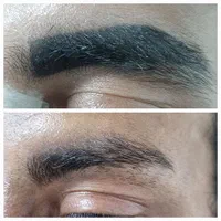 پاک کردن انواع تاتو با لیزر پیشرفته کیوسوئیچ|خدمات آرایشگری و زیبایی|اهواز, کیانپارس |دیوار