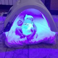 اجاره انواع دستگاه زردی نوزادان با تضمین درمان
