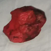 سنگ کلکسیونی برمه آتشین