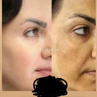 کرم سوپر معجزه