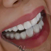 ایمپلنت و لمینیت اقساطی ( فولادشهر )|خدمات آرایشگری و زیبایی|فولادشهر, B2|دیوار