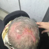پانسمان هوشمندنانوفیبرتمام گیاهی باسرعت درمان بالا|آرایشی، بهداشتی، درمانی|مشهد, هفت تیر (حافظ)|دیوار