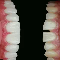 ارتودنسی اقساطی