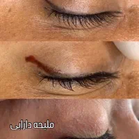 جشنواره ریموو ابرو، ریموو لب،ریمووچشم،شیدینگ لب