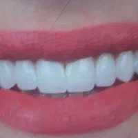 کارآموز دندانسازی